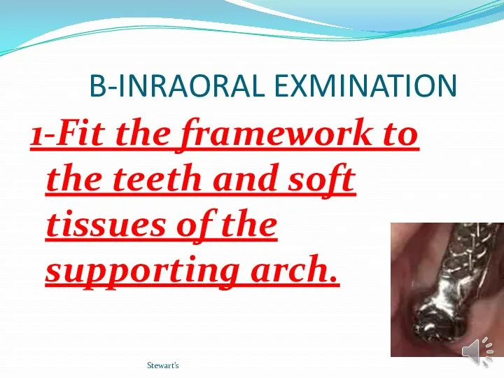 B-INRAORAL EXMINATION 1-Fit the framework to the teeth and soft tissues of the supporting arch. Stewart’s