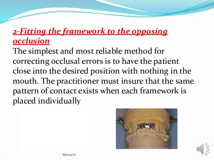 Stewart’s 2-Fitting the framework to the opposing occlusion The simplest and most reliable