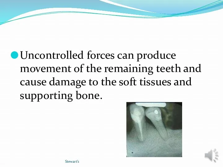 Uncontrolled forces can produce movement of the remaining teeth and cause damage to