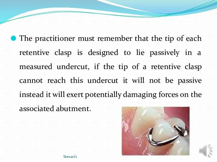 The practitioner must remember that the tip of each retentive clasp is designed