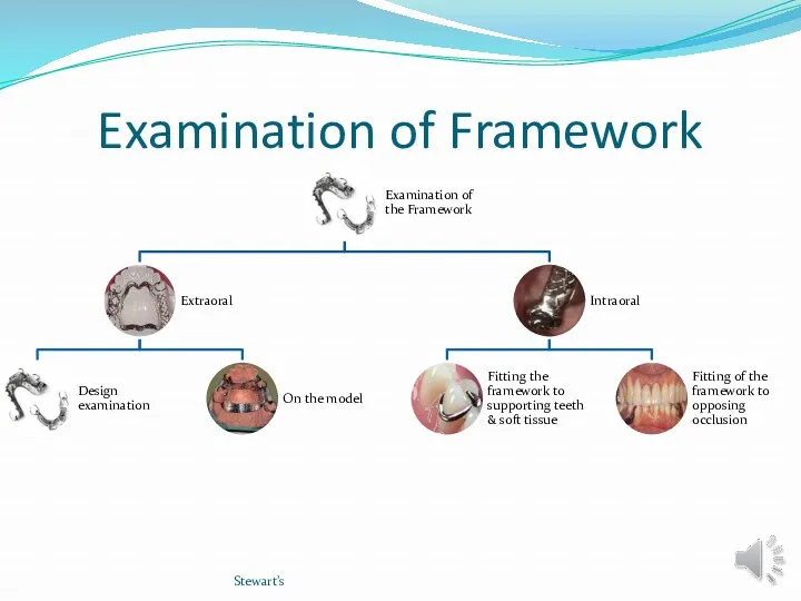 Examination of Framework Stewart’s