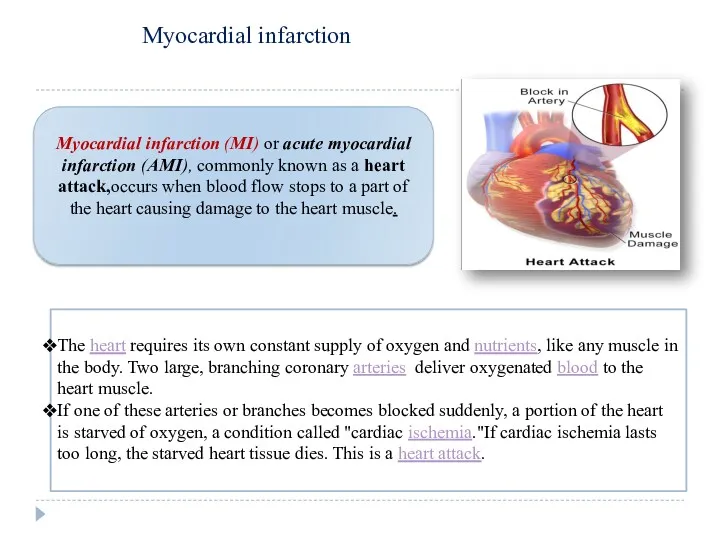 Myocardial infarction (MI) or acute myocardial infarction (AMI), commonly known