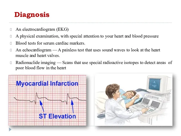 Diagnosis An electrocardiogram (EKG) A physical examination, with special attention to your heart