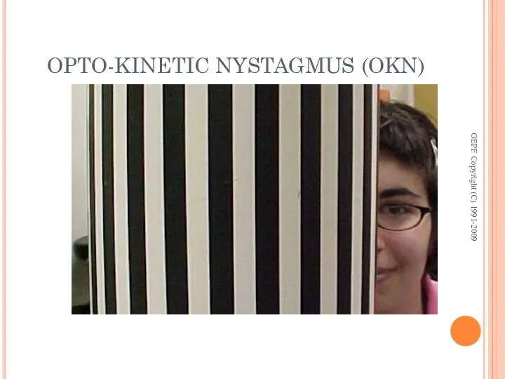 OPTO-KINETIC NYSTAGMUS (OKN) OEPF Copyright (C) 1991-2009