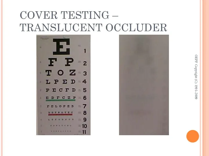 COVER TESTING – TRANSLUCENT OCCLUDER OEPF Copyright (C) 1991-2009