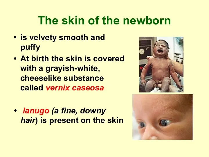 The skin of the newborn is velvety smooth and puffy