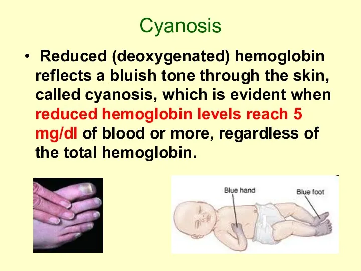 Cyanosis Reduced (deoxygenated) hemoglobin reflects a bluish tone through the