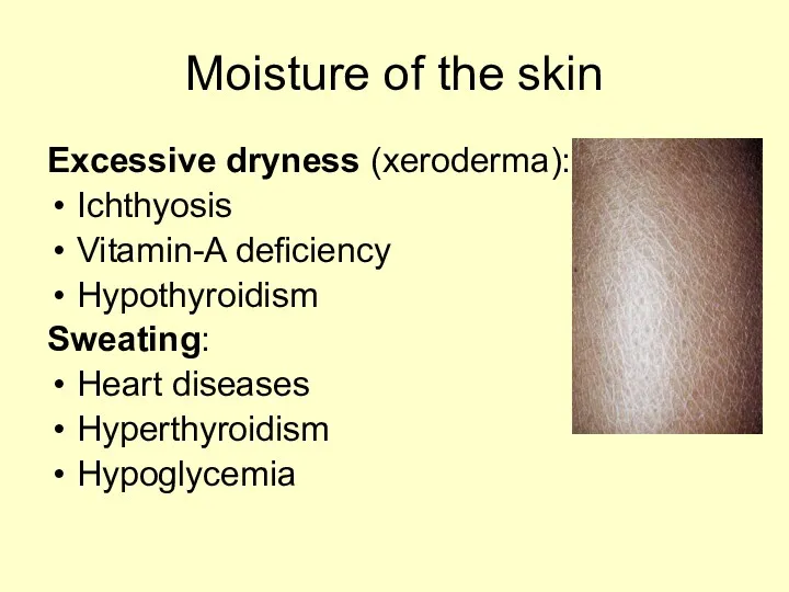 Moisture of the skin Excessive dryness (xeroderma): Ichthyosis Vitamin-A deficiency Hypothyroidism Sweating: Heart diseases Hyperthyroidism Hypoglycemia