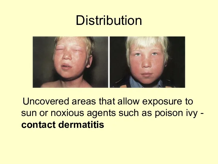 Distribution Uncovered areas that allow exposure to sun or noxious