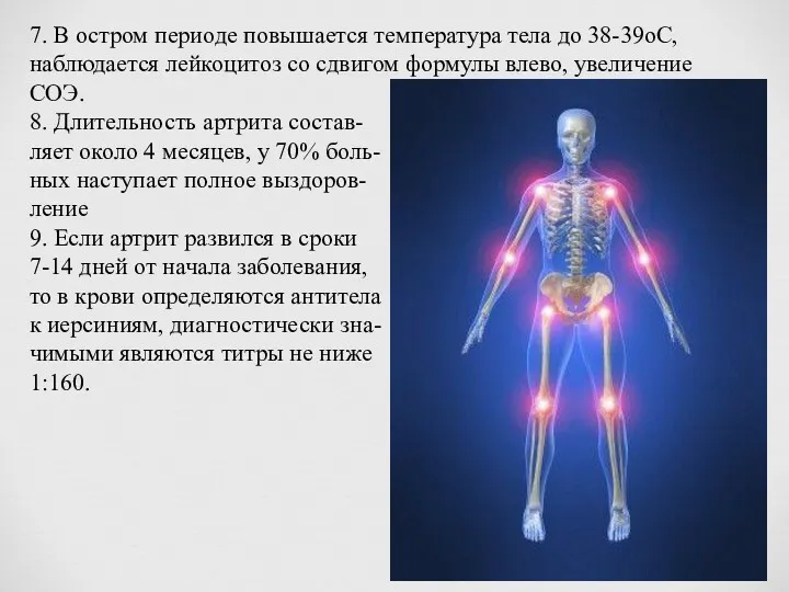 7. В остром периоде повышается температура тела до 38-39оС, наблюдается