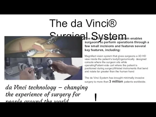 The da Vinci Surgical System enables surgeons to perform operations