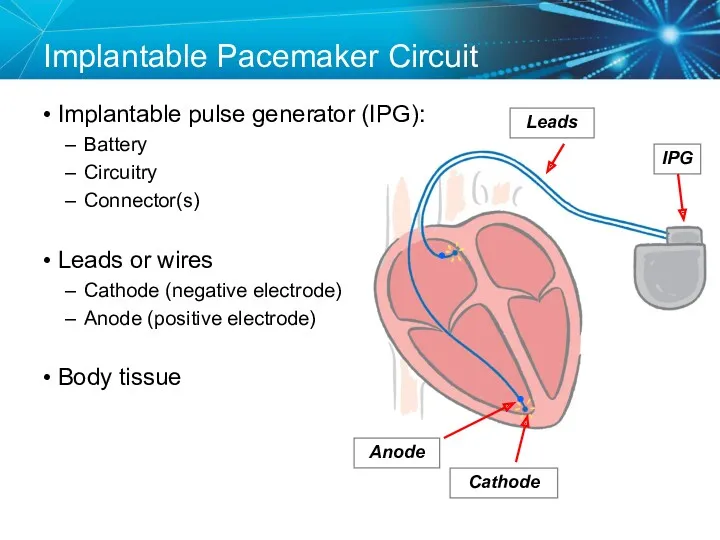 Implantable Pacemaker Circuit Implantable pulse generator (IPG): Battery Circuitry Connector(s)