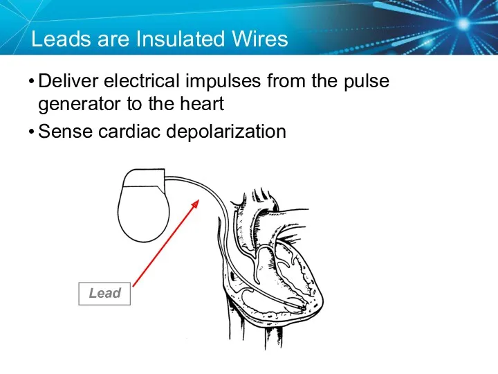 Leads are Insulated Wires Deliver electrical impulses from the pulse