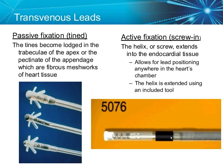 Transvenous Leads Passive fixation (tined) The tines become lodged in