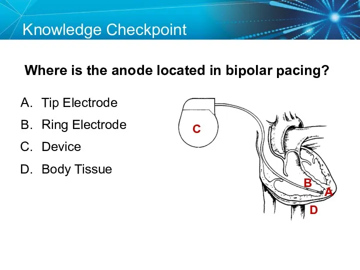 Knowledge Checkpoint Where is the anode located in bipolar pacing?
