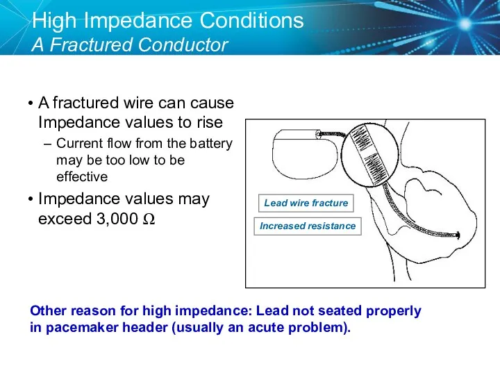 High Impedance Conditions A Fractured Conductor A fractured wire can