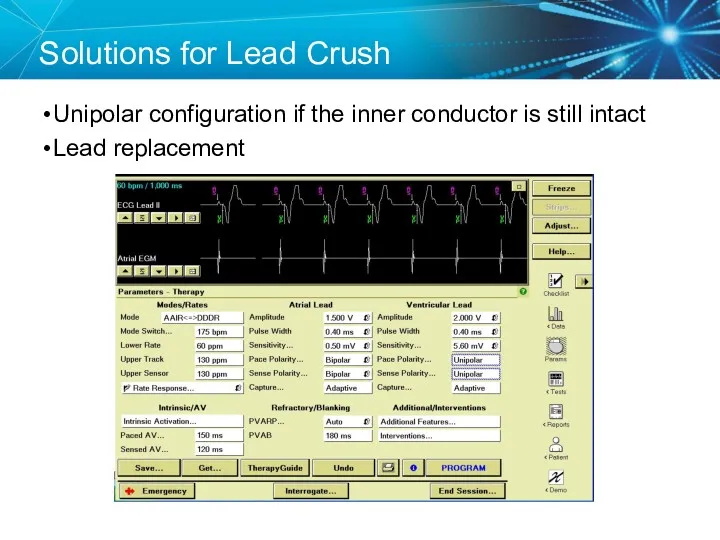 Solutions for Lead Crush Unipolar configuration if the inner conductor is still intact Lead replacement