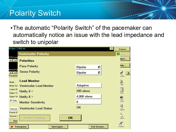 Polarity Switch The automatic “Polarity Switch” of the pacemaker can