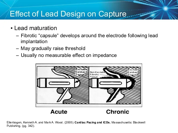 Effect of Lead Design on Capture Lead maturation Fibrotic “capsule”