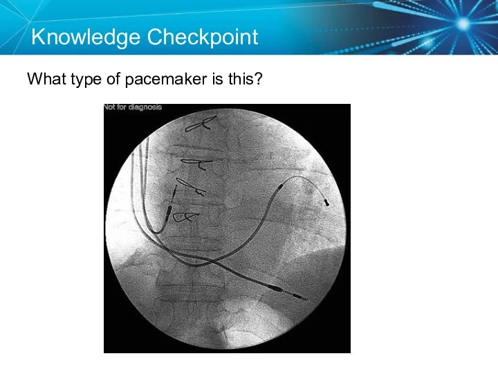 Knowledge Checkpoint What type of pacemaker is this?