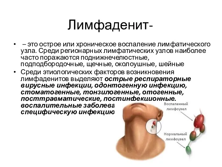 Лимфаденит- – это острое или хроническое воспаление лимфатического узла. Среди