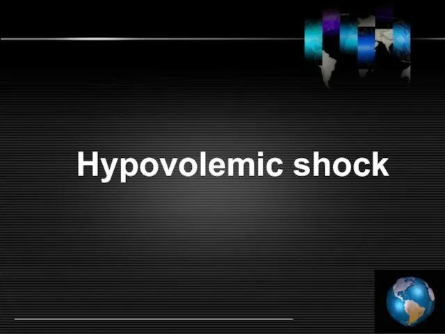 Hypovolemic shock