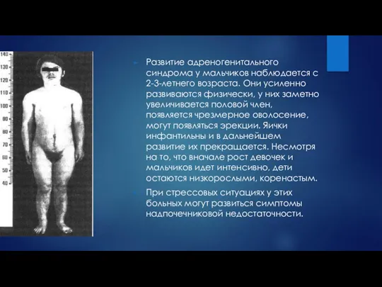 Развитие адреногенитального синдрома у мальчиков наблюдается с 2-3-летнего возраста. Они