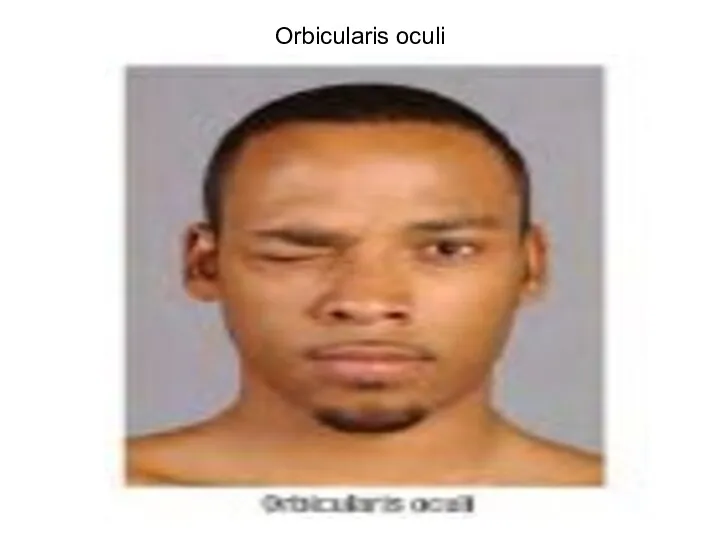 Orbicularis oculi