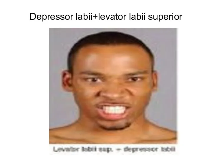 Depressor labii+levator labii superior