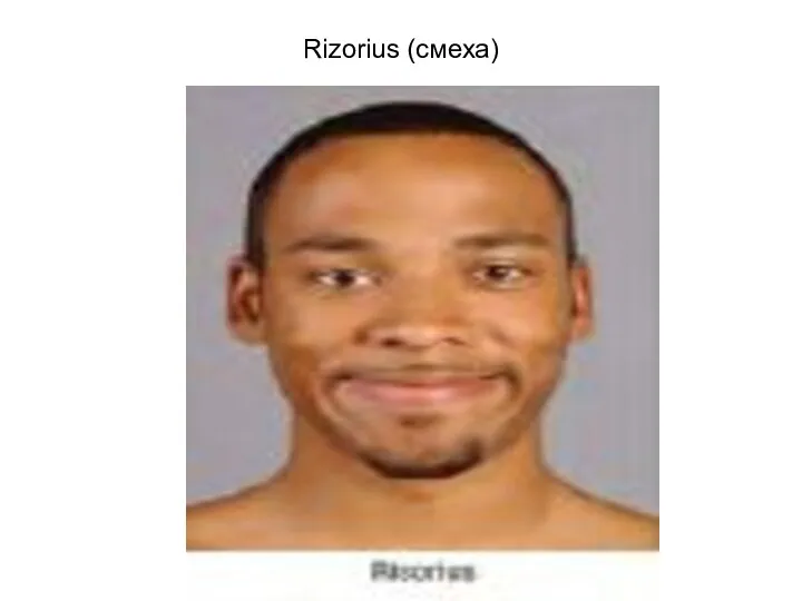 Rizorius (смеха)