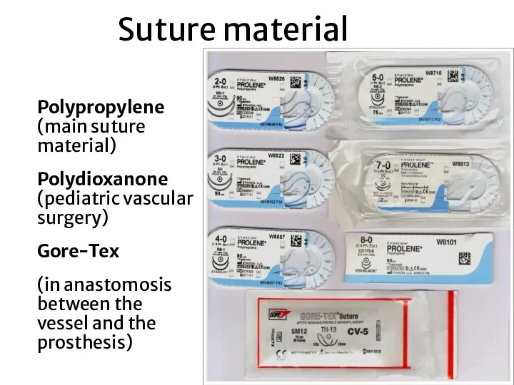 Suture material Polypropylene (main suture material) Polydioxanone (pediatric vascular surgery)