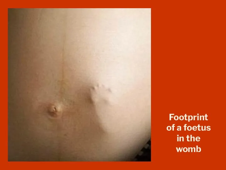 Footprint of a foetus in the womb