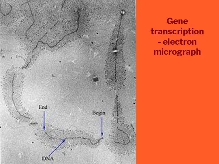 Gene transcription - electron micrograph