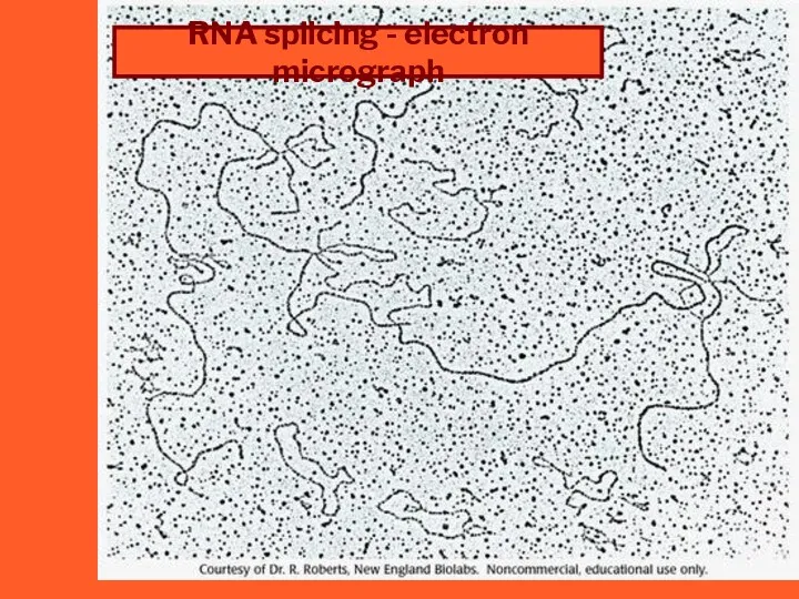 RNA splicing - electron micrograph