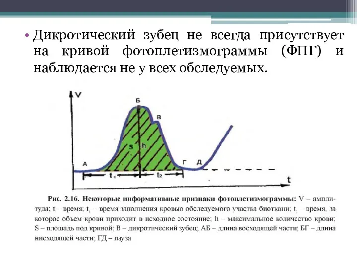 Дикротический зубец не всегда присутствует на кривой фотоплетизмограммы (ФПГ) и наблюдается не у всех обследуемых.