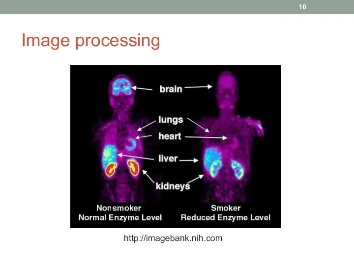 Image processing http://imagebank.nih.com