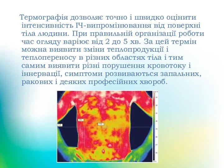 Термографія дозволяє точно і швидко оцінити інтенсивність ІЧ-випромінювання від поверхні