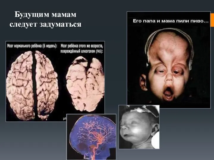 Будущим мамам следует задуматься