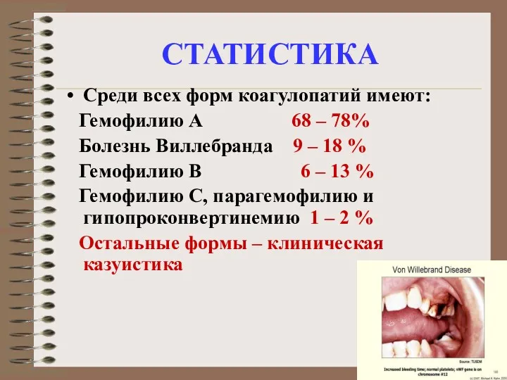 СТАТИСТИКА Среди всех форм коагулопатий имеют: Гемофилию А 68 – 78% Болезнь Виллебранда