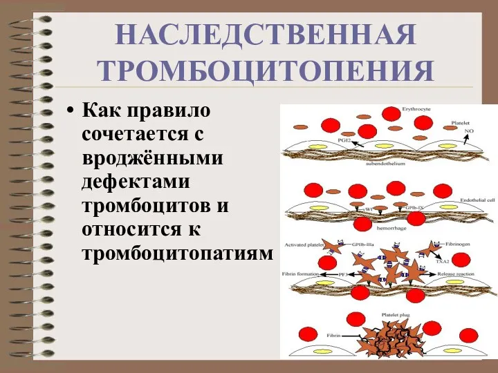 НАСЛЕДСТВЕННАЯ ТРОМБОЦИТОПЕНИЯ Как правило сочетается с вроджёнными дефектами тромбоцитов и относится к тромбоцитопатиям