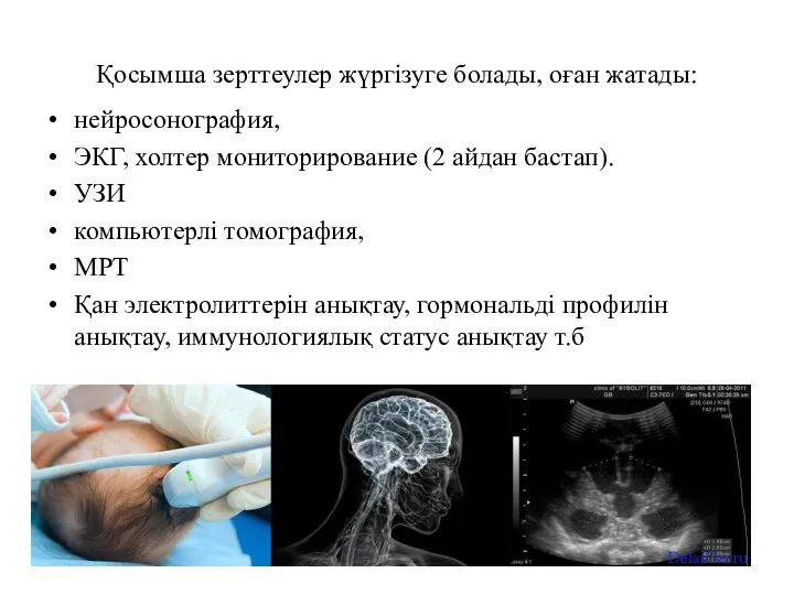 Қосымша зерттеулер жүргізуге болады, оған жатады: нейросонография, ЭКГ, холтер мониторирование