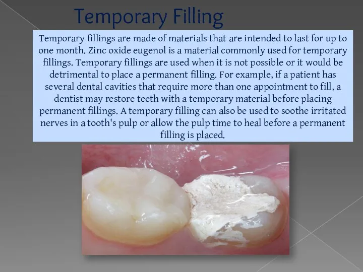 Temporary Filling Temporary fillings are made of materials that are intended to last