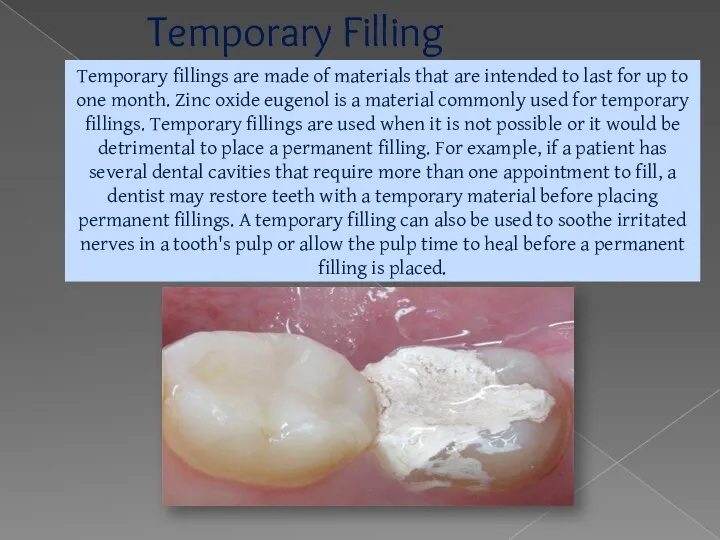 Temporary Filling Temporary fillings are made of materials that are