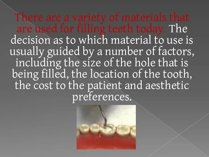 There are a variety of materials that are used for filling teeth today.