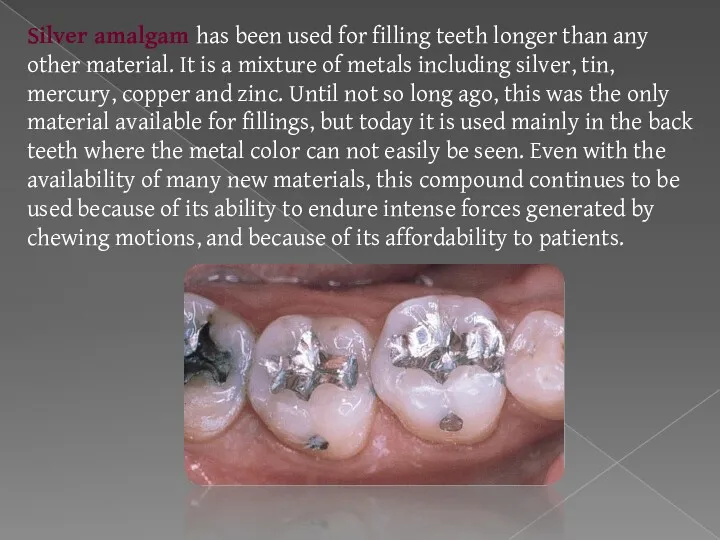 Silver amalgam has been used for filling teeth longer than any other material.