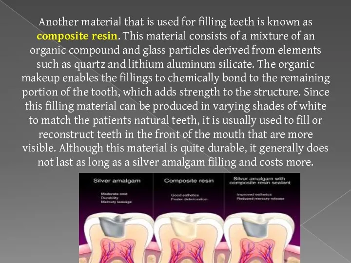 Another material that is used for filling teeth is known as composite resin.