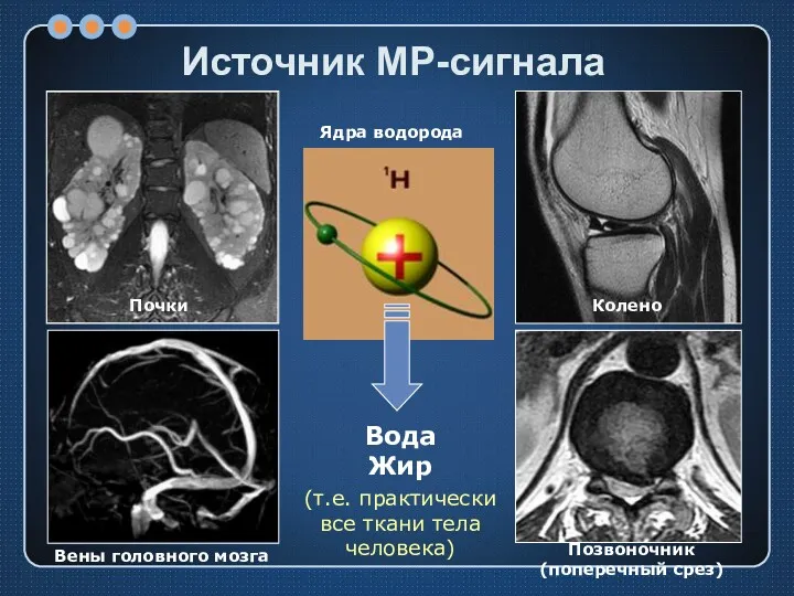 Источник МР-сигнала Вода Жир (т.е. практически все ткани тела человека)