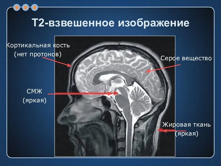 Т2-взвешенное изображение Кортикальная кость (нет протонов) СМЖ (яркая) Серое вещество Жировая ткань (яркая)