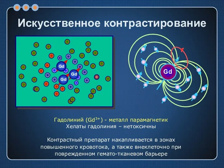 Искусственное контрастирование Гадолиний (Gd3+) - металл парамагнетик Хелаты гадолиния –