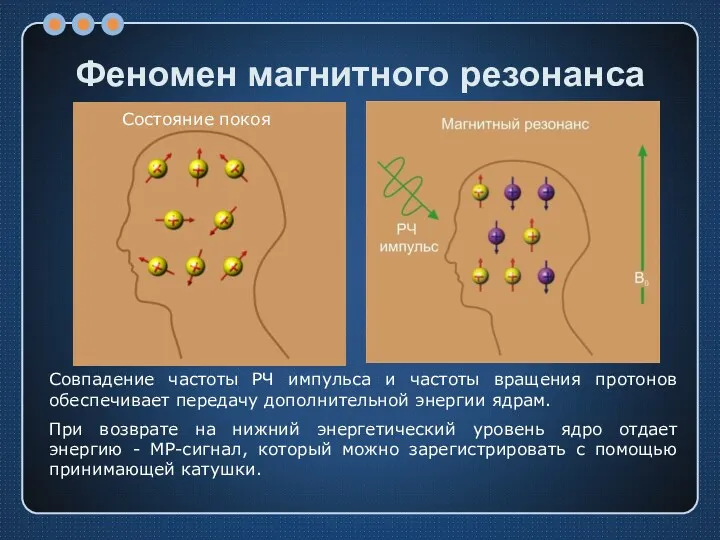 Феномен магнитного резонанса Состояние покоя Совпадение частоты РЧ импульса и